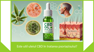 Este util uleiul CBD în tratarea psoriazisului?
